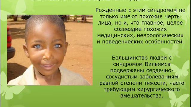 Синдром Вильямса