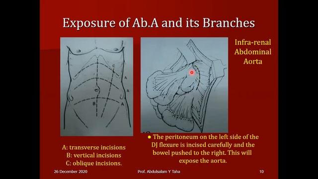 Exposure of Blood Vessels in the Chest and Abdomen смотреть онлайн