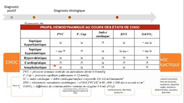 CHOC CARDIOGÉNIQUE смотреть онлайн