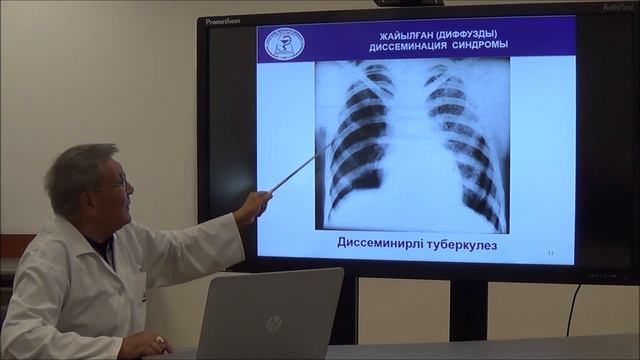 Дәріс: «Өкпе ауруларының негізгі синдромдары» смотреть онлайн