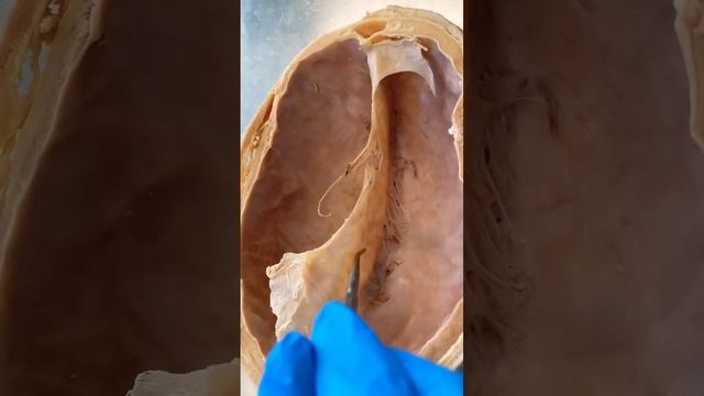 What’s Inside This REAL Human Skull? смотреть онлайн