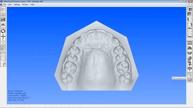 OrthotechOhio 3 D Digital Model Viewer смотреть онлайн