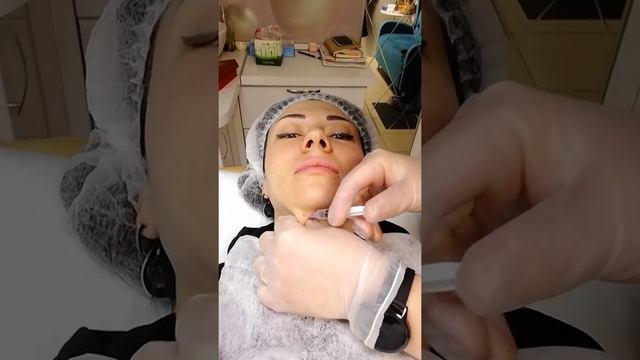 Прямой липолитик в лицо (липолитики прямого действия) смотреть онлайн