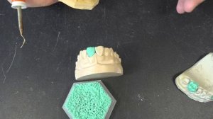 Обучение зубных техников. Моделировка зубов. Учеба зуботехника. Зубы. Зуботехническая лаборатория.