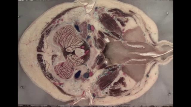 Inside the Brain: An Entire Head in Cross-Section смотреть онлайн