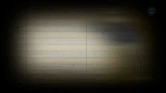 Что такое дежавю или дежавю симптом эпилепсии!?