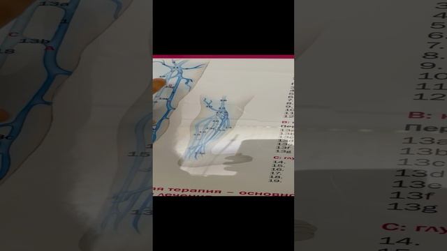 Рецидив варикоза после лазерной операции. Флеболог Москва. Флеболог. Сосудистый хирург Москва смотреть онлайн