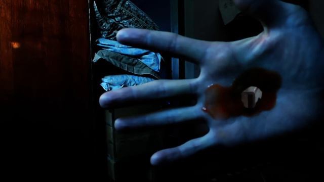 Огромная дыра в руке \ A huge hole in the hand смотреть онлайн