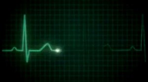 Heart beat going to death die | ecg | doctor | heart beat monitor