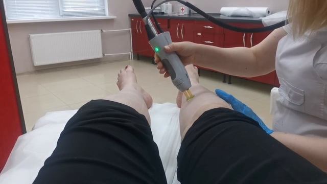 Делаем лазар эпиляцию салон Муар на ножки! смотреть онлайн