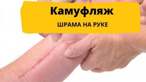 КАК УБРАТЬ ШРАМЫ? Камуфляж шрамов (рубцов) на руке. Процесс камуфляжа шрамов и результат.