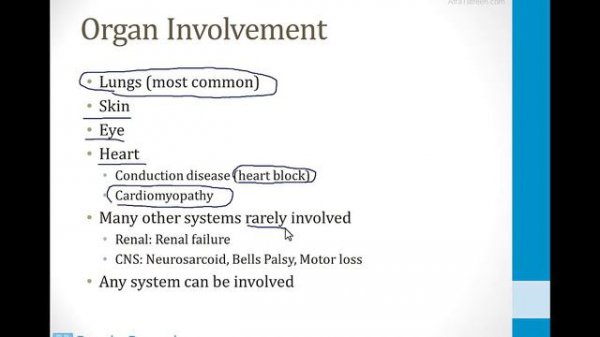 Pulmonary - 3. Other Pulmonary Topics - 7.Sarcoidosis atf