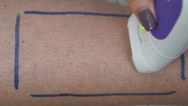 Первое использование эпилятора Braun смотреть онлайн