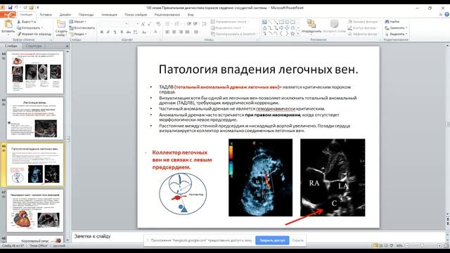 Семинар "Особенности пренатальной диагностики пороков сердечно-сосудистой системы смотреть онлайн