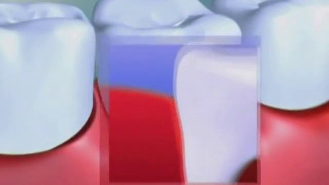 Метрогил Дента смотреть онлайн