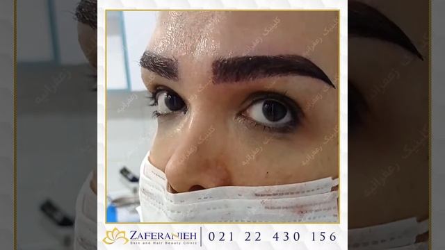 کاشت ابرو смотреть онлайн