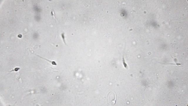 Чем отличаются микроскопы за 100$, 1000$ и 10 000$? смотреть онлайн