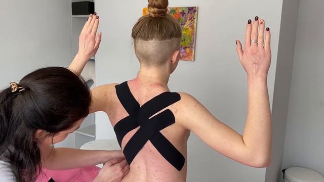 Тейпирование для коррекции осанки смотреть онлайн