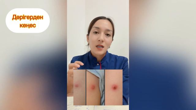 БЦЖ екпесі. БЦЖ вакцинасы. БЦЖ вакцинасы не үшін қажет? БЦЖ салған жердің іріңдеуі, қызаруы. смотреть онлайн