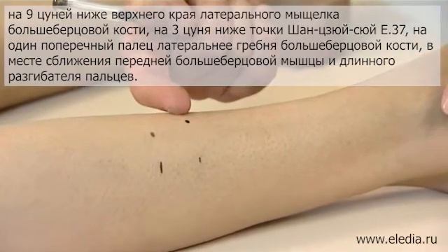 Фантомные боли смотреть онлайн