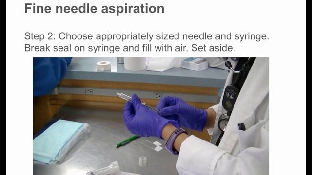 Lymph node aspiration смотреть онлайн