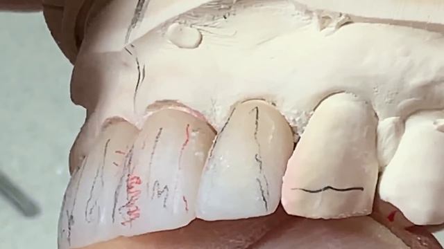 Tooth Morphology Design Techniques for Dental Lab Technicians смотреть онлайн