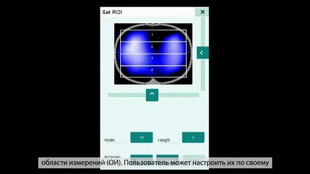Электроимпедансный томограф PulmoVista® 500: описание смотреть онлайн