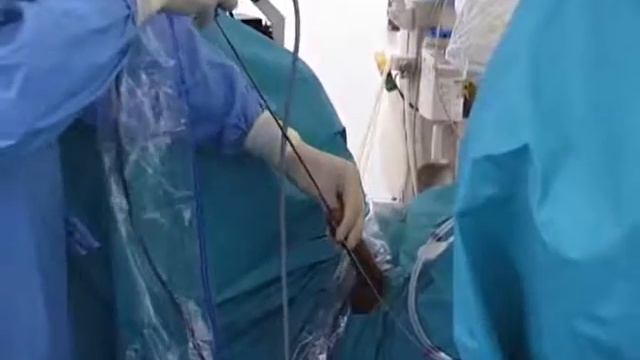 Процедура с жестким уретроскопом Rigid Ureteroscopy Procedure смотреть онлайн