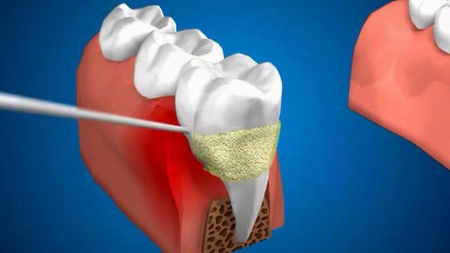 зубо десн карманы смотреть онлайн