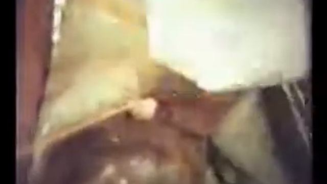 Ретроградная аппендэктомия русский смотреть онлайн