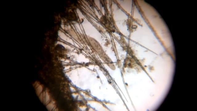 Неопознанные черви под микроскопом. смотреть онлайн