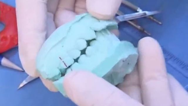 Diagnosis and Management of Malocclusion and Dentofacial Deformities, 2/e by O.P. Kharbanda - 5 смотреть онлайн