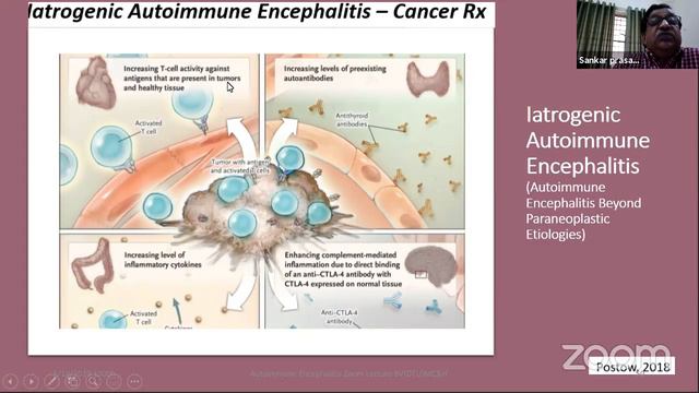 Autoimmune Encephalitis||Neurology Lectures||Neuro ePathshala by Dr.SP Gorthi смотреть онлайн