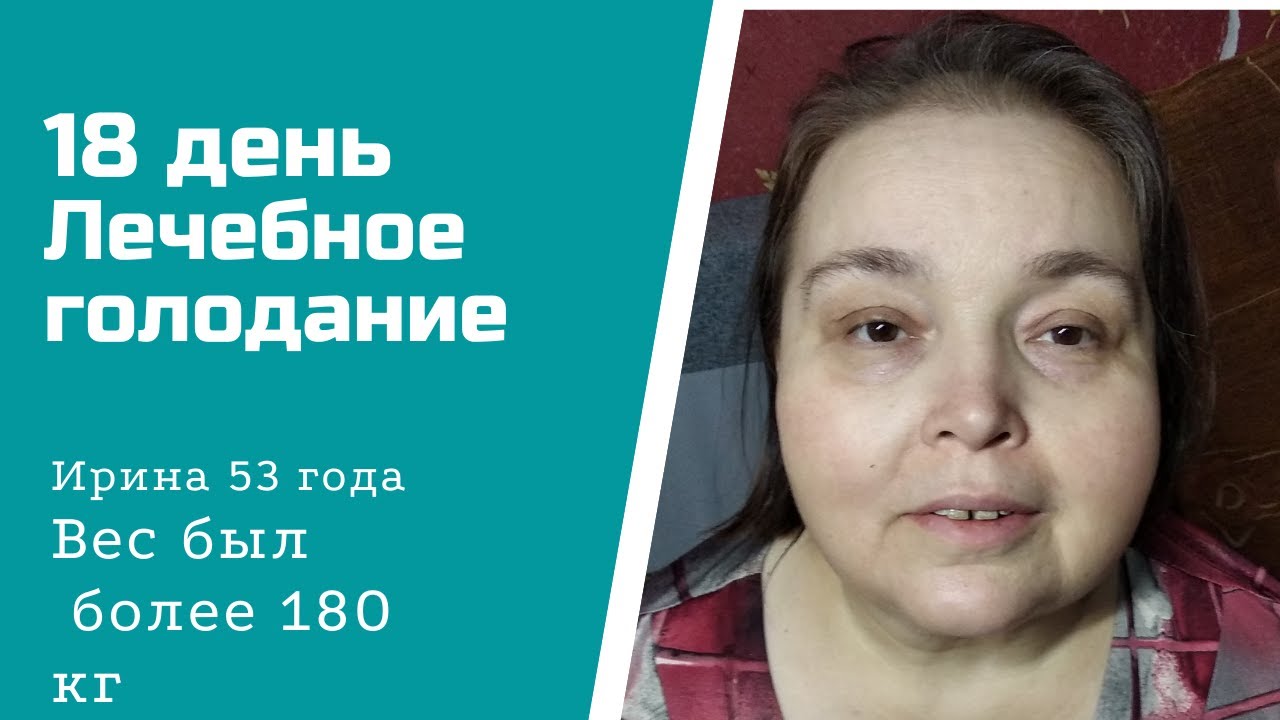 Голодание при большом весе 18 день.mp4 смотреть онлайн
