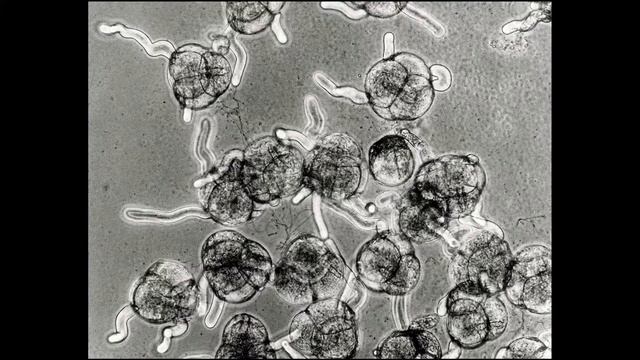 Rhododendron Pollen смотреть онлайн