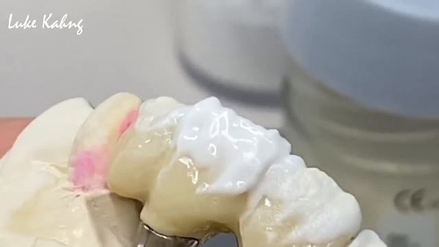 How to Restore Metal Ceramics смотреть онлайн