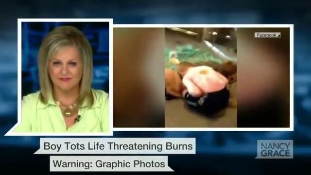 Graphic pics: Boys suffer severe sunburn at daycare смотреть онлайн