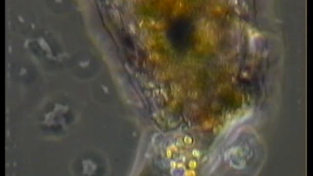 TECAMEBA - TESTATE AMOEBA. смотреть онлайн