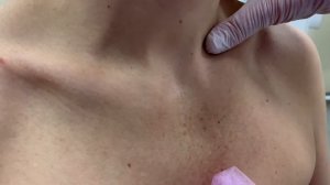 Тонкости лимфатического массажа при панических атаках .