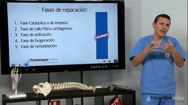 Fracturas de muñeca, radio y cúbito - Tratamiento y cuidados para su recuperación смотреть онлайн