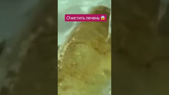 Буквально за 4дня можно очистить печень от шлаков. очень эффективный. #здоровьеотприроды смотреть онлайн