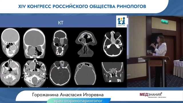 Детская ринология и онкология от простого к сложному смотреть онлайн
