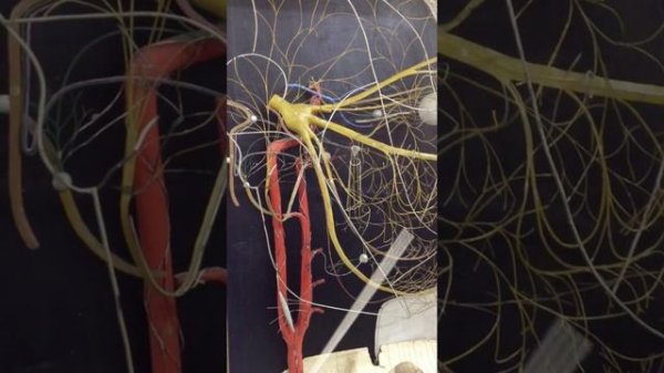 Анатомия (тройничный нерв)