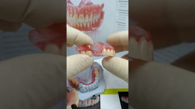 Акриловый зубной протез через 10 лет! смотреть онлайн