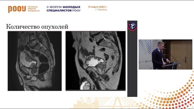 Лучевая диагностика РМП. Особенности классификации VIRADS для клиницистов. Кабанов Д. О. смотреть онлайн