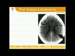 Введение в #ГНМ