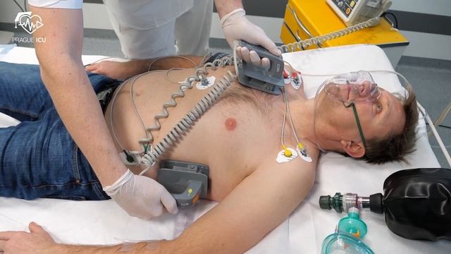 Electrical cardioversion смотреть онлайн