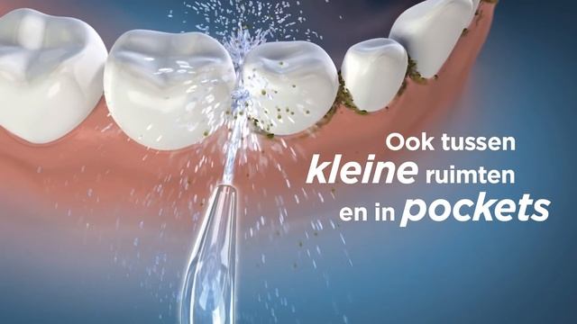 20171023 Waterpik Waterflosser смотреть онлайн