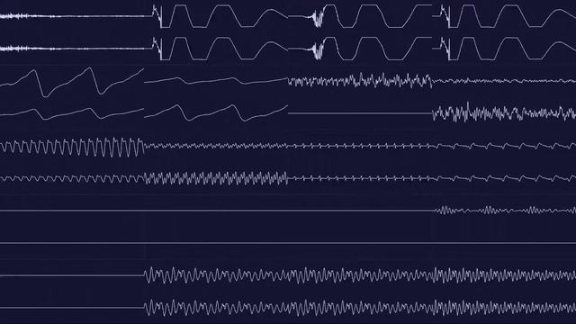 Jeroen Tel - Hello 1997 [XM] (Oscilloscope View) смотреть онлайн