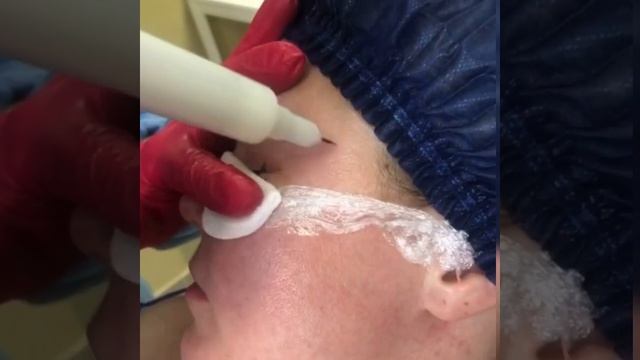 Холодная плазма смотреть онлайн